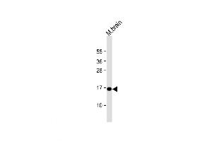 Western Blot at 1:1000 dilution + mouse brain lysate Lysates/proteins at 20 ug per lane. (Complexin 1 Antikörper  (AA 33-60))