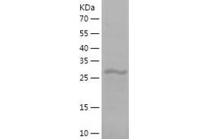 Western Blotting (WB) image for Ribosomal Protein L8 (RPL8) (AA 1-257) protein (His tag) (ABIN7124889) (RPL8 Protein (AA 1-257) (His tag))