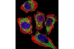 Fluorescent confocal image of Hela cell stained with CA2 Antibody (N-term). (CA2 Antikörper  (N-Term))
