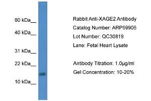 WB Suggested Anti-XAGE2  Antibody Titration: 0. (XAGE2 Antikörper  (Middle Region))