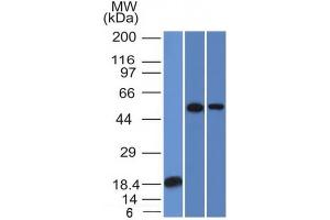 Western Blot Analysis (A) Recombinant protein (B) A549 (C) A431 TOX3 Mouse Monoclonal Antibody (TOX3/1124).