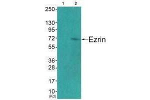 Western blot analysis of extracts from COS7 cells (Lane 2), using Ezrin (Ab-478) antiobdy. (Ezrin Antikörper  (Tyr478))