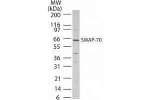 Image no. 1 for anti-SWAP Switching B-Cell Complex 70kDa Subunit (SWAP70) (AA 300-350) antibody (ABIN199974) (SWAP70 Antikörper  (AA 300-350))