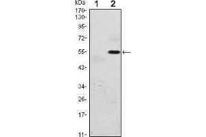 Western blot analysis using EIF2AK3 mAb against HEK293 (1) and EIF2AK3(AA: 929-1116)-hIgGFc transfected HEK293 (2) cell lysate. (PERK Antikörper)