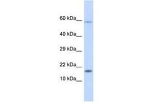 Image no. 1 for anti-Hect Domain and RLD 4 (HERC4) (AA 39-76) antibody (ABIN6746210)