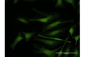 Immunofluorescence of purified MaxPab antibody to IFI35 on HeLa cell. (IFI35 Antikörper  (AA 1-288))