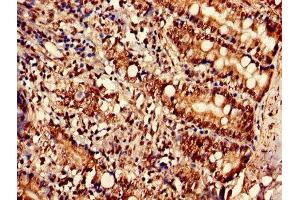 Immunohistochemistry of paraffin-embedded human small intestine tissue using ABIN7170231 at dilution of 1:100 (SLC35F2 Antikörper  (AA 335-374))