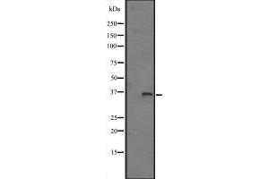 Western blot analysis of FN3K expression in HepG2 cell lysate ;,The lane on the left is treated with the antigen-specific peptide. (FN3K Antikörper  (Internal Region))