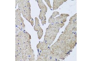 Immunohistochemistry of paraffin-embedded mouse heart using HBA2 antibody at dilution of 1:100 (x40 lens).