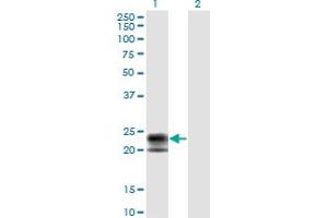 Western Blot analysis of TNFRSF17 expression in transfected 293T cell line by TNFRSF17 monoclonal antibody (M01), clone 1F10. (BCMA Antikörper  (AA 1-184))