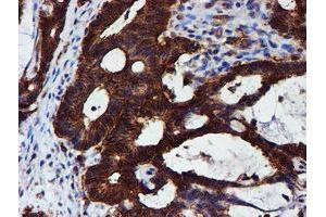 Image no. 16 for anti-Chromosome 1 Open Reading Frame 50 (C1ORF50) antibody (ABIN1497033)