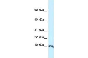 WB Suggested Anti-Sumo1 Antibody   Titration: 1. (SUMO1 Antikörper  (N-Term))