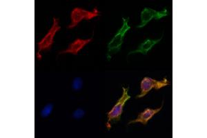 ABIN6262775 and ABIN6269025 staining HepG2 by IF/ICC. (KRT16 Antikörper  (C-Term))
