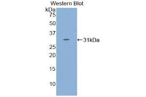 Detection of Recombinant STAT4, Human using Polyclonal Antibody to Signal Transducer And Activator Of Transcription 4 (STAT4) (STAT4 Antikörper  (AA 505-737))
