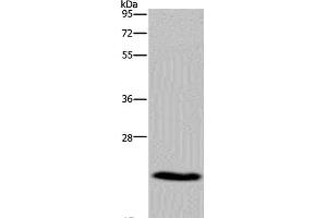 Western Blot analysis of Mouse heart tissue using CMTM5 Polyclonal Antibody at dilution of 1:400 (CMTM5 Antikörper)