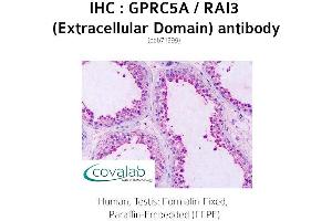 Image no. 2 for anti-G Protein-Coupled Receptor, Family C, Group 5, Member A (GPRC5A) (2nd Extracellular Domain) antibody (ABIN1735207) (GPRC5A Antikörper  (2nd Extracellular Domain))
