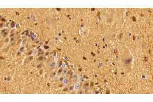 Detection of S100B in Bovine Cerebellum Tissue using Polyclonal Antibody to S100 Calcium Binding Protein B (S100B) (S100B Antikörper  (AA 1-92))