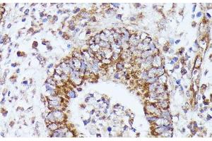 Immunohistochemistry (Paraffin-embedded Sections) (IHC (p)) image for anti-Dihydrolipoyl Transacetylase (DLAT) antibody (ABIN7257932)