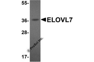 Western Blotting (WB) image for anti-ELOVL Fatty Acid Elongase 7 (ELOVL7) (N-Term) antibody (ABIN1031366) (ELOVL7 Antikörper  (N-Term))