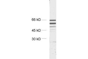 dilution: 1 : 2000, sample: crude synaptosomal fraction of rat brain (P2) (STXBP2 Antikörper)