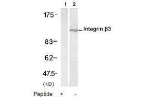 Image no. 2 for anti-Integrin beta 3 (ITGB3) (AA 771-775) antibody (ABIN197246) (Integrin beta 3 Antikörper  (AA 771-775))