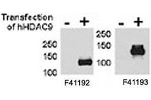 HDAC9 antibody NSJ# F41192 and NSJ# F41193 were tested by WB and IP-WB using HeLa and HeLa-HDAC9 transfected cells.