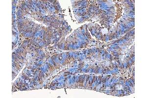 IHC analysis of SART3 using anti-SART3 antibody (ABIN7600151).