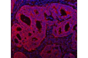 IF analysis of TMC7 using anti-TMC7 antibody (ABIN7602499). (TMC7 Antikörper  (AA 8-723))