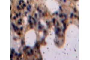 IHC-P analysis of Lung tissue, with DAB staining. (LIFR Antikörper  (AA 522-691))