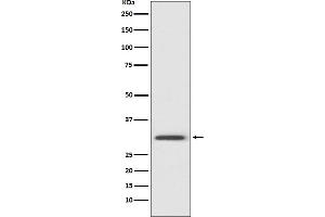 Western Blotting (WB) image for anti-Annexin A5 (ANXA5) antibody (ABIN7606954)