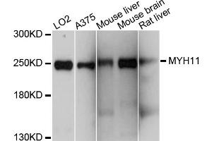 Western blot analysis of extracts of various cell lines, using MYH11 antibody (ABIN4904464) at 1:1000 dilution. (MYH11 Antikörper)