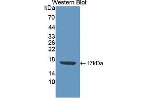 Detection of Recombinant CDA, Human using Polyclonal Antibody to Cytidine Deaminase (CDA) (CDA Antikörper  (AA 2-146))