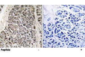 Immunohistochemistry analysis of paraffin-embedded human pancreas tissue using MRPS21 polyclonal antibody . (MRPS21 Antikörper)