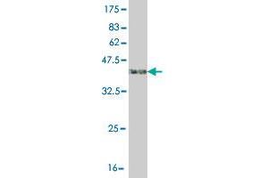 Western Blot detection against Immunogen (41. (ASK1 Antikörper  (AA 1231-1374))