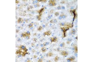 Immunohistochemistry of paraffin-embedded mouse liver using NCL antibody at dilution of 1:200 (40x lens). (Nucleolin Antikörper)
