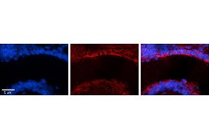 Immunohistochemistry (IHC) image for anti-MICAL-Like 1 (MICALL1) (N-Term) antibody (ABIN2784573)