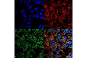 Immunocytochemistry/Immunofluorescence analysis using Rabbit Anti-BDNF Polyclonal Antibody . (BDNF Antikörper  (N-Term) (Atto 594))