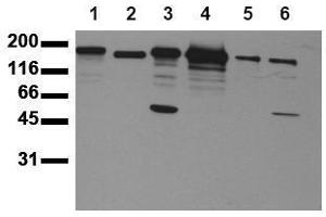 Western Blotting (WB) image for anti-Receptor tyrosine-protein kinase erbB-2 (ErbB2/Her2) (AA 1240-1260) antibody (ABIN126791) (ErbB2/Her2 Antikörper  (AA 1240-1260))