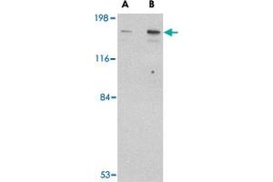 Western blot analysis of CLIP1 in rat brain tissue lysate with CLIP1 polyclonal antibody  at (A) 0. (CLIP1 Antikörper  (C-Term))