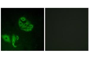 Immunofluorescence analysis of A549 cells, using GPR20 antibody. (GPR20 Antikörper  (C-Term))