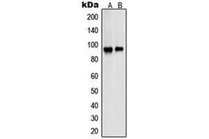 Western blot analysis of PSMD2 expression in A431 (A), HeLa (B) whole cell lysates.