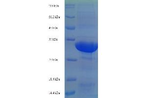 SDS-PAGE (SDS) image for Tripartite Motif Containing 24 (TRIM24) (AA 891-1012), (partial) protein (His-SUMO Tag) (ABIN5710552) (TRIM24 Protein (AA 891-1012, partial) (His-SUMO Tag))
