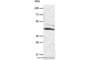 Western blot analysis of A549 cell, using SLC16A7 Polyclonal Antibody at dilution of 1:450 (SLC16A7 Antikörper)