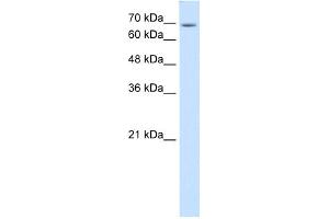 WB Suggested Anti-USP48 Antibody Titration:  0.