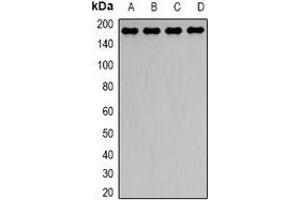 Western blot analysis of Dynactin 1 expression in Hela (A), HepG2 (B), mouse brain (C), mouse lung (D) whole cell lysates. (Dynactin 1 Antikörper)