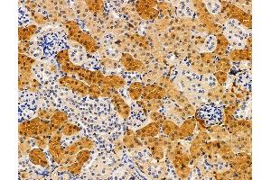 ABIN7095895 and ABIN7099957 at 1/100 staining mouse kidney tissue by IHC-P. (RDH12 Antikörper)