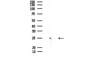 anti-Prostate Stem Cell Antigen (PSCA) antibody