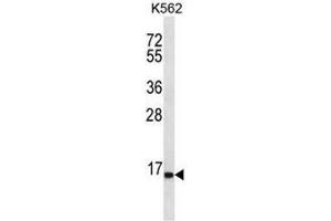 SPINK8 Antibody (C-term) western blot analysis in K562 cell line lysates (35µg/lane). (SPINK8 Antikörper  (C-Term))