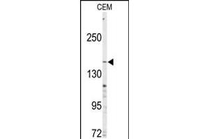 Western blot analysis of anti-ABCC4 Antibody in CEM cell line lysates (35ug/lane) (ABCC4 Antikörper  (C-Term))