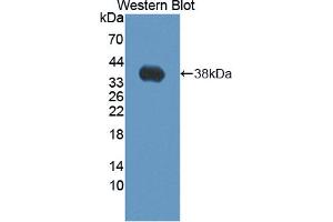 Western blot analysis of the recombinant protein. (SFRP1 Antikörper  (AA 32-314))